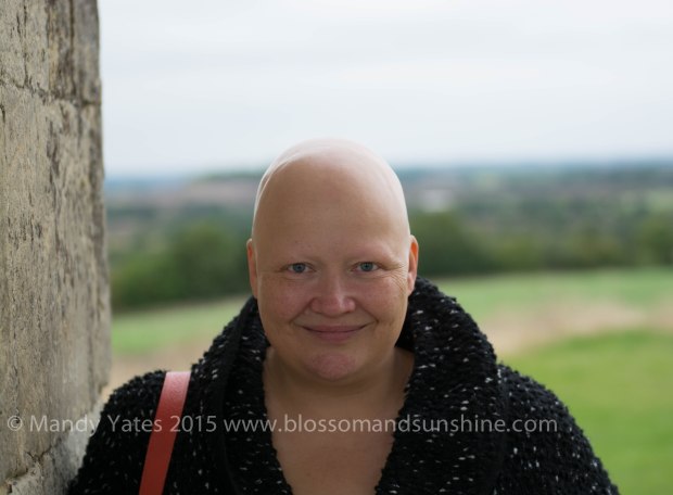 Chesterton Windmill 7